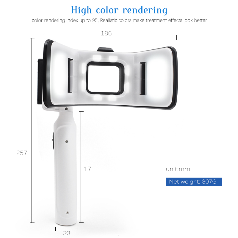 Professional Twin Flash Dental - đánh giá và giá Photography Mobile Lighting